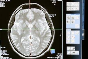 virtual anxiety therapy to heal anxiety naturally
